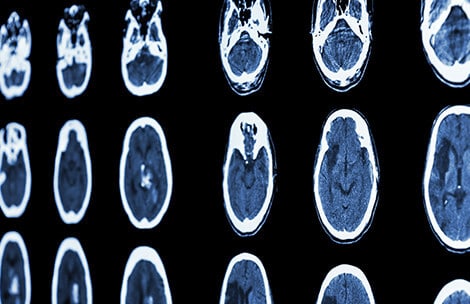 brain-injuries.jpg