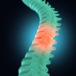 spinal cord injury lawyer oakland