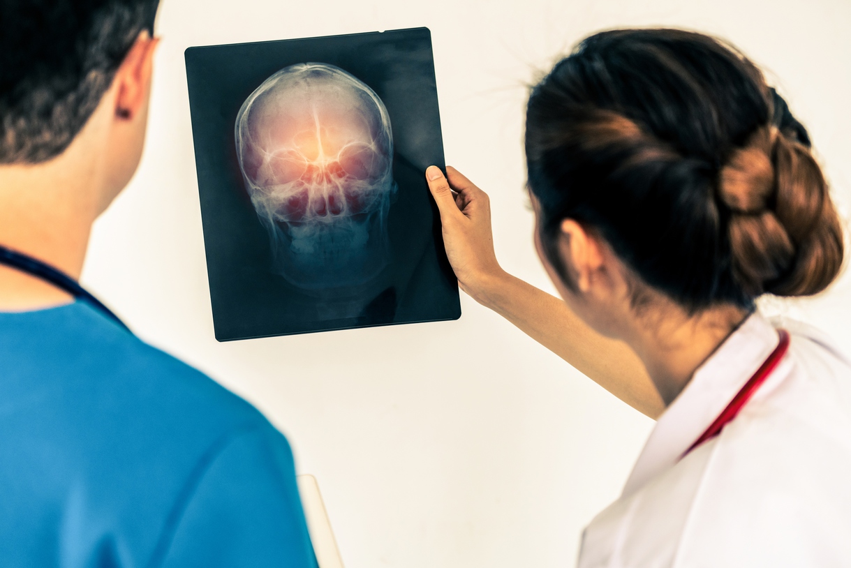 Brain Injury Lawyer Role